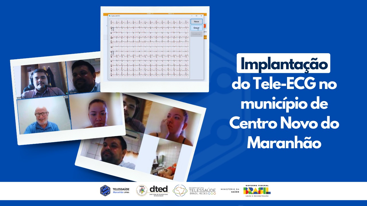 Implantação do ponto de Tele-ECG, no município de Centro Novo – Maranhão